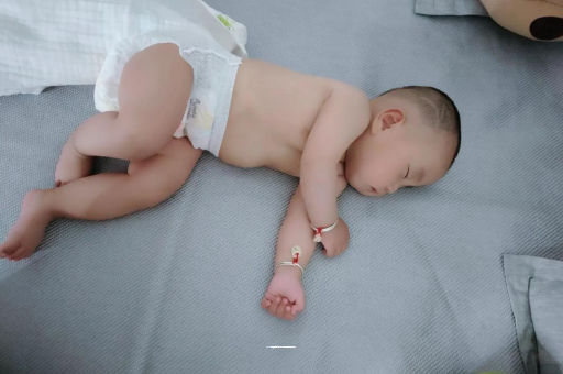 玉溪宝宝头上长痱子